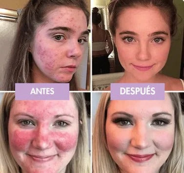 BASE DE MAQUILLAJE GLOWSKIN + BROCHA DE REGALO